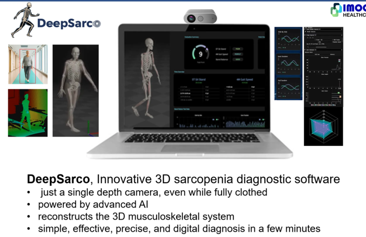 Система DeepSarco для диагностики саркопении за 30 секунд