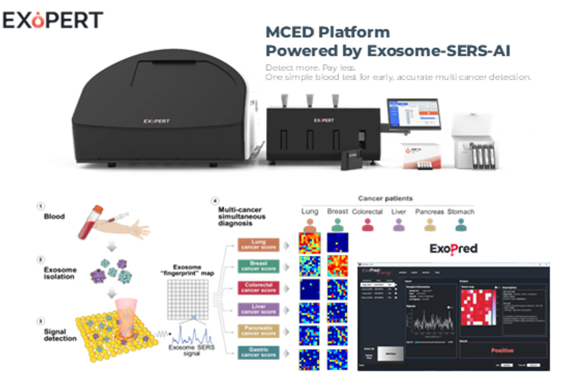 Полностью автоматизированная платформа для анализа экзотом