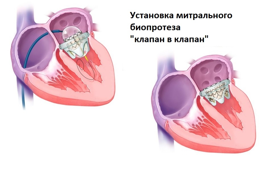 z07u6stltsx9nf92usg4_0rk8fcag9h54akksb5yojni3jkenwqg3uqn_twoqndktc6vvpw4mkqe8kmfpwuvwi_e.jpg (194 KB)